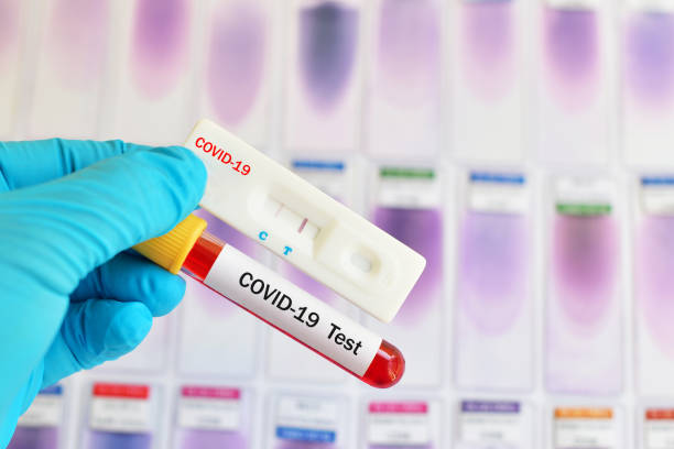 The Rising Need for Reliable Widespread COVID-19 Testing